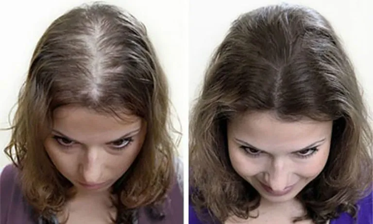 Phân biệt loại tóc dựa trên loại da của mình