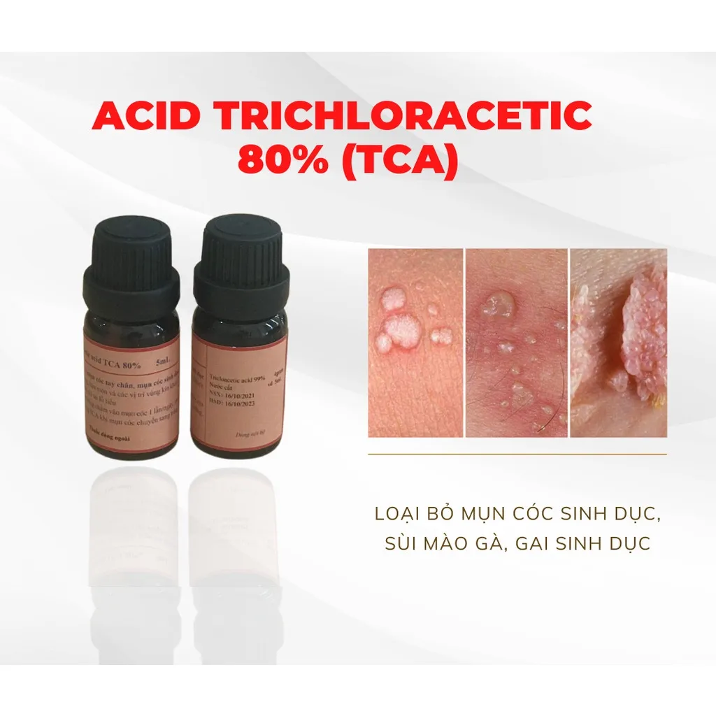 Axit Trichloroacetic (TCA) trong lăn kim và peel da kết hợp