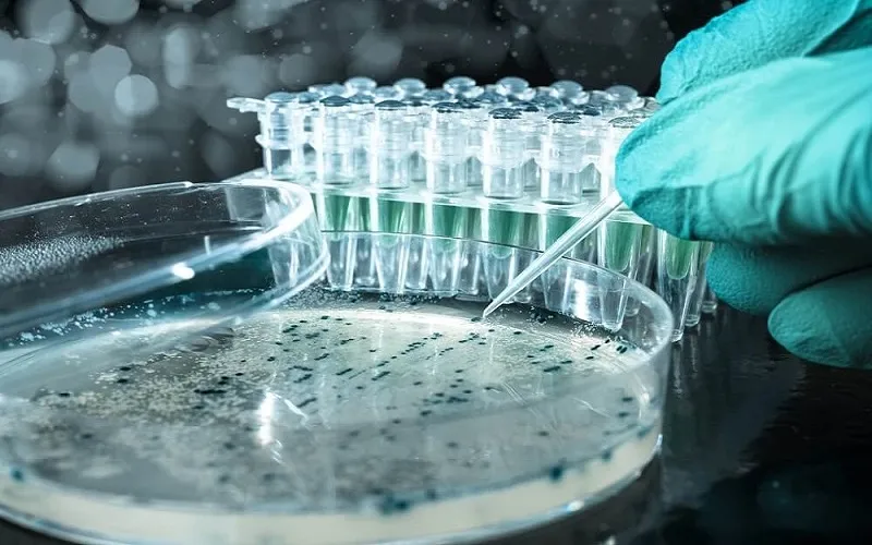 Vật liệu cho việc nuôi cấy vi khuẩn thường được lấy từ mụn mủ
