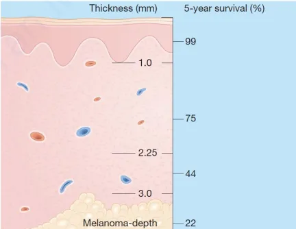 Tỷ lệ sống sót liên quan đến độ sâu xâm lấn (độ dày được đo bằng milimét)