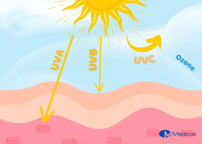 Tác động của các loại tia UV đến da