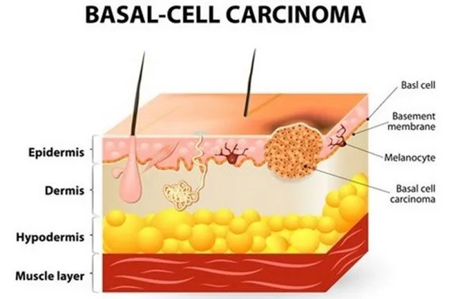 cấu trúc và chức năng của da - Lớp tế bào đáy (Basal cell layer)