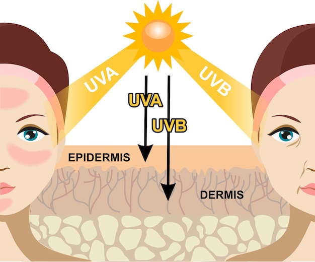 Tác hại của tia UVA, UVB lên da
